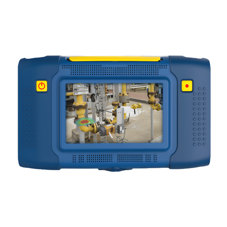 SDT Ultrasound – Camera siêu âm SonaVu™